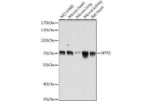 Western blot analysis of extracts of various cell lines using NPR3 Polyclonal Antibody at dilution of 1:1000. (NPR3 anticorps)
