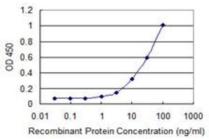Detection limit for recombinant GST tagged LCMT1 is 0.