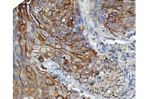 anti-S100 Calcium Binding Protein A14 (S100A14) (C-Term) antibody