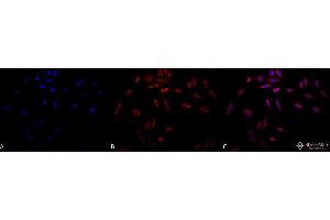 Immunocytochemistry/Immunofluorescence analysis using Mouse Anti-Hsp47 Monoclonal Antibody, Clone 1C4-1A6 .