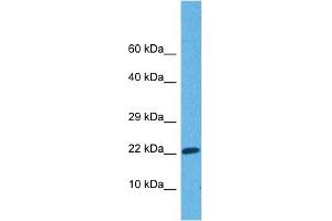 Host:  Rabbit  Target Name:  GADD45B  Sample Tissue:  Human Lung Tumor  Antibody Dilution:  1ug/ml