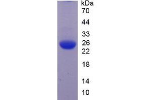 SDS-PAGE of Protein Standard from the Kit  (Highly purified E. (JAG1 Kit ELISA)