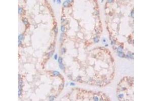 Used in DAB staining on fromalin fixed paraffin- embedded Kidney tissue