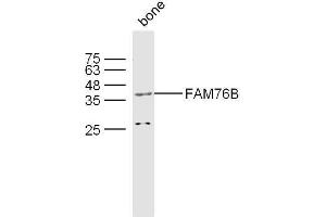 Mouse bone lysates probed with FAM76B Polyclonal Antibody, unconjugated  at 1:300 overnight at 4°C followed by a conjugated secondary antibody at 1:10000 for 60 minutes at 37°C. (FAM76B anticorps)