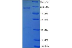 SDS-PAGE (SDS) image for Tumor Protein P53 (TP53) (AA 1-387), (full length) protein (His-SUMO Tag) (ABIN5710532)