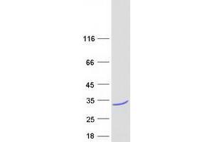 Validation with Western Blot