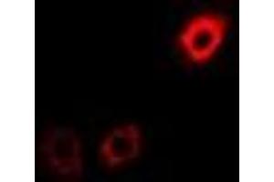 Immunofluorescent analysis of eIF3H staining in U2OS cells.