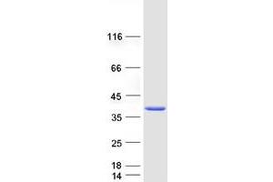 Validation with Western Blot