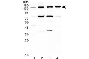 Western blot testing of 1) human HeLa, 2) human HepG2, 3) rat liver and 4) mouse liver lysate with ITGA5 antibody at 0.