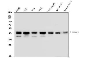Western blot analysis of hnRNP D/AUF1/HNRNPD using anti-hnRNP D/AUF1/HNRNPD antibody (ABIN7602592). (HNRNPD/AUF1 anticorps  (AA 88-246))