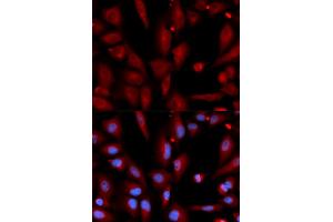 Immunofluorescence analysis of U2OS cells using WIF1 antibody (ABIN5973119). (WIF1 anticorps)
