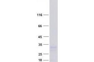Validation with Western Blot