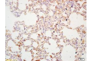 Formalin-fixed and paraffin embedded mouse lung labeled with Rabbit Anti DcR1 Polyclonal Antibody, Unconjugated  at 1:200 followed by conjugation to the secondary antibody and DAB staining