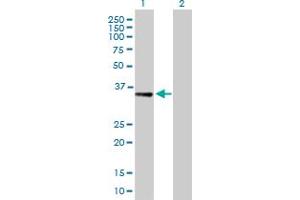 Western Blot analysis of RBKS expression in transfected 293T cell line by RBKS MaxPab polyclonal antibody. (Ribokinase anticorps  (AA 1-322))