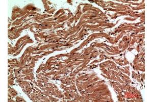 Immunohistochemistry (IHC) analysis of paraffin-embedded Human Heart, antibody was diluted at 1:100.