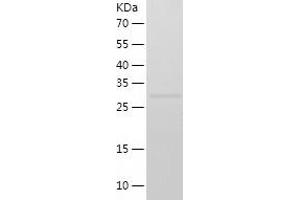 Western Blotting (WB) image for Suppressor of Variegation 3-9 Homolog 1 (Drosophila) (SUV39H1) (AA 82-412) protein (His-IF2DI Tag) (ABIN7125258)