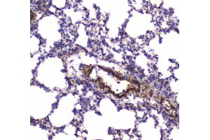 IHC analysis of MYLK using anti-MYLK antibody . (MYLK anticorps  (AA 1441-1709))