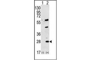 Western blot analysis of GREM1 (arrow) using Gremlin-1 / GREM1 Antibody (C-term) Cat. (GREM1 anticorps  (C-Term))