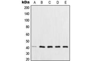Western blot analysis of XPA expression in HCT116 (A), HeLa (B), HepG2 (C), MCF7 (D), NIH3T3 (E) whole cell lysates. (XPA anticorps  (C-Term))