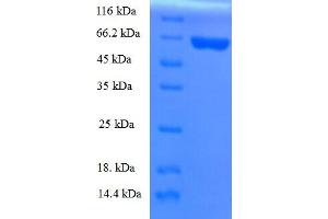 SDS-PAGE (SDS) image for Apolipoprotein A-V (APOA5) (AA 27-367) protein (GST tag) (ABIN5709061)