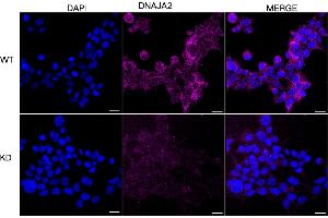 Immunocytochemical staining of HeLa cells using DNAJA2 antibody (ABIN7798372), 1:1,000), Top panel: wild-type (WT), Bottom panal: DNAJA2 shRNA knockdown (KD).