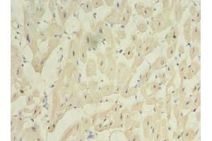 Immunohistochemistry of paraffin-embedded human heart tissue using ABIN7175069 at dilution of 1:100 (C2orf27A anticorps  (AA 3-174))