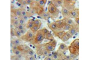 Used in DAB staining on fromalin fixed paraffin-embedded Liver tissue (BCL3 anticorps  (AA 82-341))