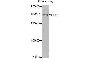 Western Blotting (WB) image for anti-Deleted in Liver Cancer 1 (DLC1) antibody (ABIN1872283) (DLC1 anticorps)