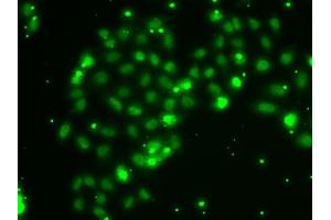 Immunofluorescence analysis of A-549 cells using TXNL4B antibody (ABIN6133086, ABIN6149739, ABIN6149740 and ABIN6222926).