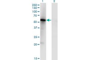 Western Blot analysis of MKNK1 expression in transfected 293T cell line by MKNK1 monoclonal antibody (M05), clone 5E2. (MKNK1 anticorps  (AA 1-465))
