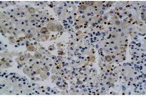Immunohistochemistry (IHC) image for anti-Interferon gamma (IFNG) (AA 81-166) antibody (ABIN669141)
