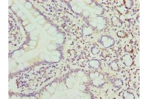 Immunohistochemistry of paraffin-embedded human small intestine tissue using ABIN7149063 at dilution of 1:100 (CRISPLD1 anticorps  (AA 24-300))