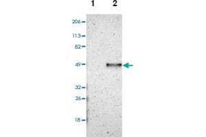Western blot analysis of Lane 1: Human cell line RT-4, Lane 2: Human cell line U-251MG sp with CADM3 polyclonal antibody . (CADM3 anticorps)