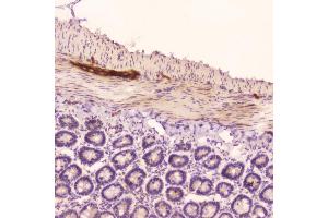 IHC analysis of ANP using anti-ANP antibody (ABIN5693163).