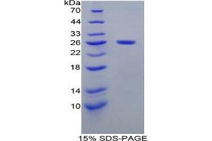 SDS-PAGE analysis of Mouse Smad1 Protein. (SMAD1 Protéine)