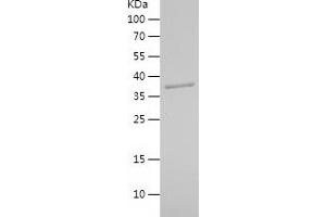 Western Blotting (WB) image for Heat Shock Protein 90kDa beta (Grp94), Member 1 (HSP90B1) (AA 282-409) protein (His-IF2DI Tag) (ABIN7123279)