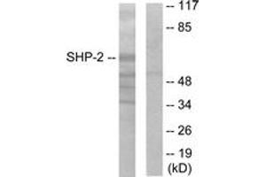 Western blot analysis of extracts from A431 cells, using SHP-2 (Ab-542) Antibody. (PTPN11 anticorps  (AA 508-557))