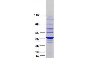 Validation with Western Blot