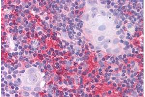 Human Thymus: Formalin-Fixed, Paraffin-Embedded (FFPE)