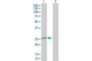 Western Blot analysis of SOD2 expression in transfected 293T cell line by SOD2 MaxPab polyclonal antibody. (SOD2 anticorps  (AA 1-222))
