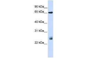 WB Suggested Anti-TRIM8 Antibody Titration:  0. (TRIM8 anticorps  (N-Term))