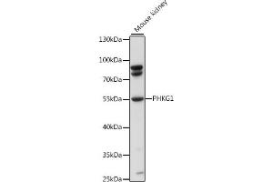 anti-phosphorylase Kinase, gamma 1 (Muscle) (PHKG1) (AA 245-350) antibody