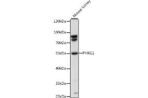 Western blot analysis of extracts of mouse kidney, using PHKG1 antibody (ABIN7269368) at 1:1000 dilution. (PHKG1 anticorps  (AA 245-350))