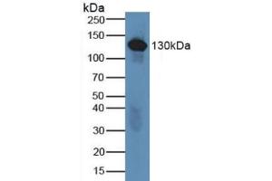 Detection of C6 in Human Serum using Polyclonal Antibody to Complement Component 6 (C6) (C6 anticorps  (AA 682-934))