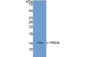 Western blot analysis of recombinant Rat ENG. (Endoglin anticorps  (AA 26-136))