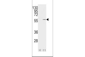 Western blot analysis of VIM(arrow) using rabbit polyclonal Vimentin Antibody (S82) (ABIN389211 and ABIN2839366).