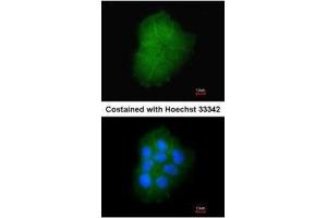 ICC/IF Image Immunofluorescence analysis of paraformaldehyde-fixed A431, using Transmembrane protein 147, antibody at 1:200 dilution. (TMEM147 anticorps)