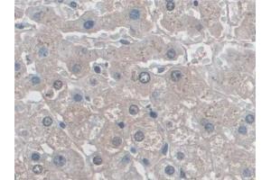 Detection of MHCB in Human Liver Tissue using Polyclonal Antibody to Major Histocompatibility Complex Class I B (MHCB)