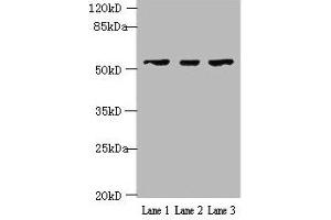 Western blot All lanes: IFIT5 antibody at 2 μg/mL Lane 1: A375 whole cell lysate Lane 2: Jurkat whole cell lysate Lane 3: HepG2 whole cell lysate Secondary Goat polyclonal to rabbit IgG at 1/10000 dilution Predicted band size: 56, 51 kDa Observed band size: 56 kDa (IFIT5 anticorps  (AA 107-320))