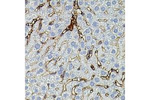Immunohistochemistry of paraffin-embedded mouse liver using MMP9 antibody (ABIN4904401) at dilution of 1:100 (40x lens). (MMP 9 anticorps)